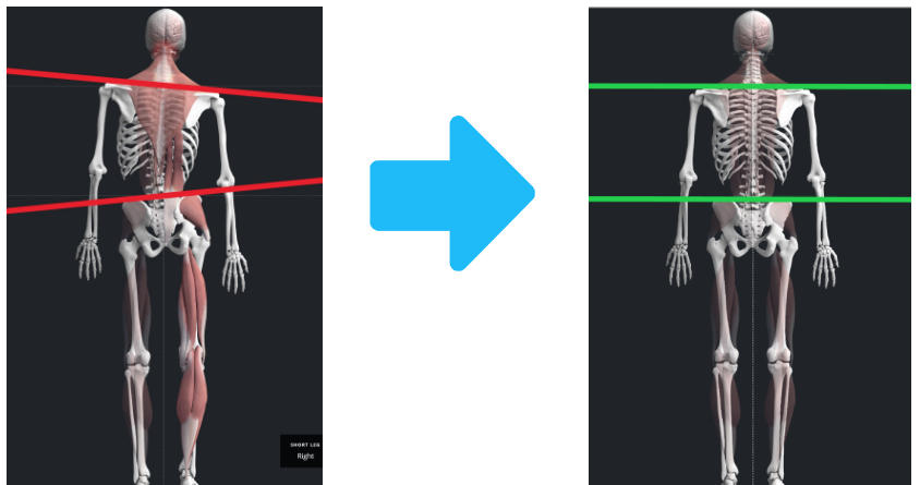 Posture Pre and Post Realignment